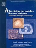 Atlas clinique des maladies des voies aériennes : Endoscopie, radiologie, histopathologie (1Cédérom) (Ancien prix éditeur : 87 euros)