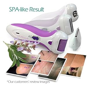 LaFlantine™ 4 in 1 Electric Device Epilator - Callus Remover - Shaver - Hair Clipper. Lady Everyday Care. Gently to All… - Image 7