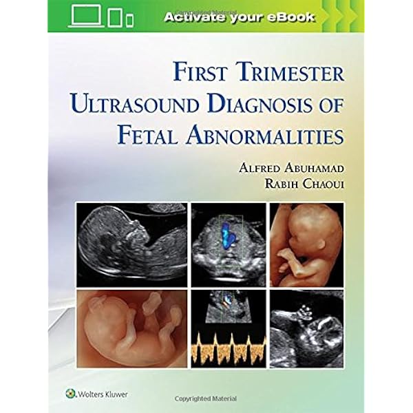 First Trimester Ultrasound Diagnostics Of Fetal Abnormalities Amazon De Abuhamad Alfred M D Chaoui Rabih M D Bucher