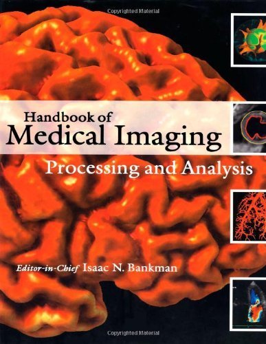 Handbook of Medical Imaging: Processing and Analysis Management (Biomedical Engineering) by Academic Press (2000-10-13)