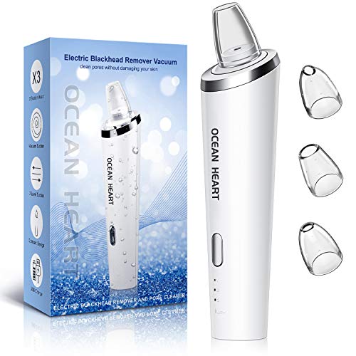 Extractor puntos negros