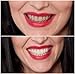 Billion Dollar Smile ULTRA VIOLET Sunbed Teeth Whitening Kit
