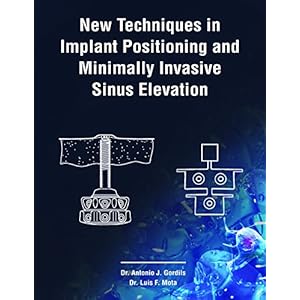 NEW TECHNIQUES IN IMPLANT POSITIONING AND MINIMALLY INVASIVE SINUS ELEVATION