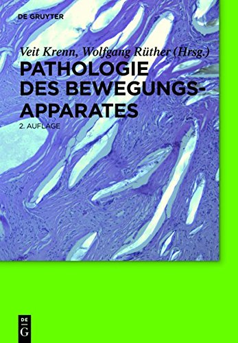 Download Pathologie des Bewegungsapparates Download Pathologie des Bewegungsapparates
