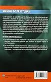 Image de Manual de fracturas