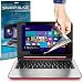 Produktbild Smart Glaze ( Pack Of 10 ) Apple Macbook Air 11 11.6" Laptop Case Brand New Luxury Crystal Clear Premium-LCD-Display-Schutzfolien-Packs mit Poliertuch & Application-Karte by Fone-Case