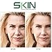 Skinapeel Clinical Skincare London Regenerative Anti Ageing, Scar Reducing, Acne Treatment Snail Cream for Day & Night- Made in the UK- 50g