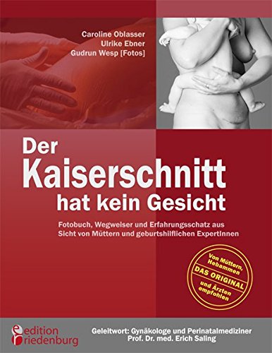 Download Der Kaiserschnitt hat kein Gesicht Download Der Kaiserschnitt hat kein Gesicht