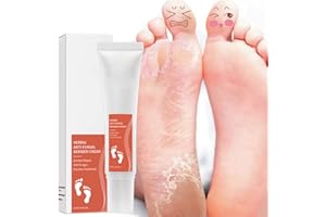 ALLBESTAYE Allbesta Herbal Anti-Fungal Foot Cream Infection Treatment Anti-Inflammatory Relieve Itching