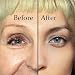 Ultra-Fine Vitamin C Serum, with Hyaluronic Acid and Aloe and Vitamin E. Skin Nutrient, helps to Smooth Facial Skin, Fade Age Spots, repairs Sun Damage, Lighten Dark Eye Circles, Wrinkles and Fine Lines – 2 oz.