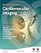 Produktbild The ESC Textbook of Cardiovascular Imaging (European Society of Cardiology Publications)