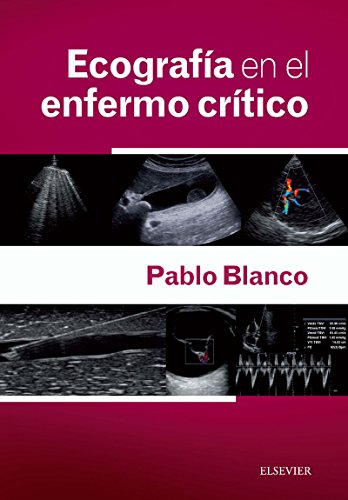 Ecografía en el enfermo crítico