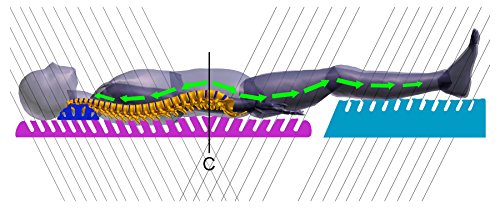 Preisvergleich Produktbild Therapeutisches System - Detensor 18%