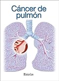 Image de Miniatlas Cáncer de pulmón