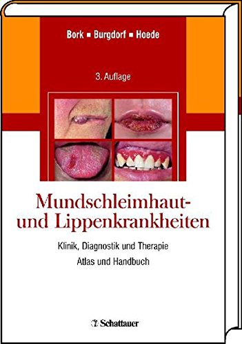 Preisvergleich Produktbild Mundschleimhaut- und Lippenkrankheiten: Klinik, Diagnostik und Therapie Atlas und Handbuch