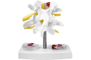 Sarini Anatomisk ländryggsskiva, vetenskaplig ryggradsmodell, anatomi, diskbråck, demonstrationsmodell, mänsklig ryggrad, dis