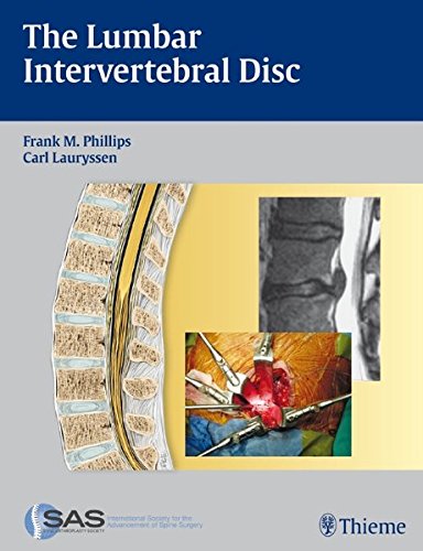 Preisvergleich Produktbild The Lumbar Intervertebral Disc
