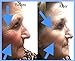 Amazing Miracle Ceferulichyaluronic Hyaluronic Anti Ageing Vitamin Minute Serum anti aging moisturizer cream Anti aging night cream Anti Aging Night Anti Aging anti aging moisturizer tightening serum eye miracle