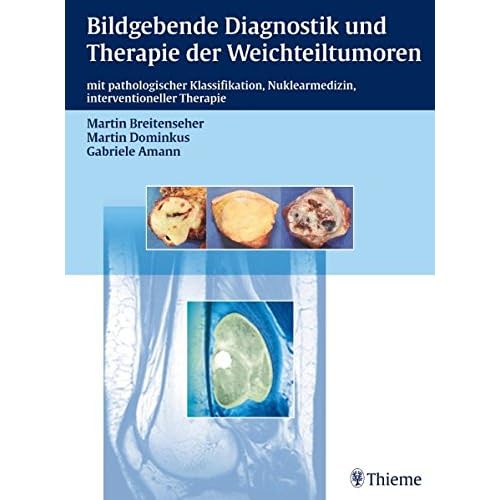 [PDF] Bildgebende Diagnostik und Therapie der Weichteiltumoren: mit pathologischer Klassifikation - Nuklearmedizin - interventionelle Therapie KOSTENLOS DOWNLOAD