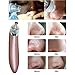 Stoga Blackhead Removal Electronic Facial Pore Cleaner Acne Remover Utilizes Pore Vacuum Extraction