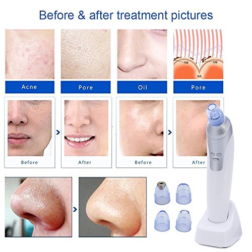 Beautystar Diamond Dermabrasion Microdermabrasion, Portable Vacuum Skin Peeling Machine Blackhead Suction Extraction Machine Removal for Facial Rejuvenation with USB Adapter - 6