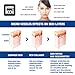 Koi Beauty Micro Needle Electric Auto Derma Stamp Pen Skin Therapy for Face, Eyes and Body - Remove Stretch Marks, Wrinkles, Scars, Acne, Cellulite, Large Pores, Blackheads, Lines, Blemishes, Main Device + 10 Piece 12 Needle Cartridge. Easy to Operate.