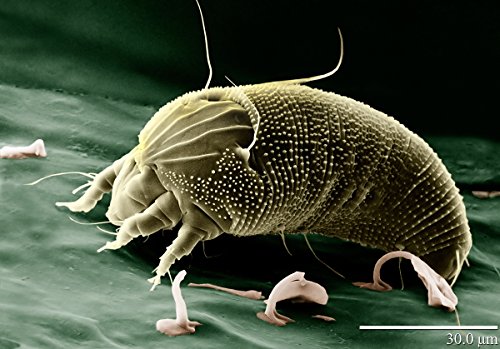 Ultraschall Milbencontroller gegen Milben Hausstaubmilben Allergie - 2