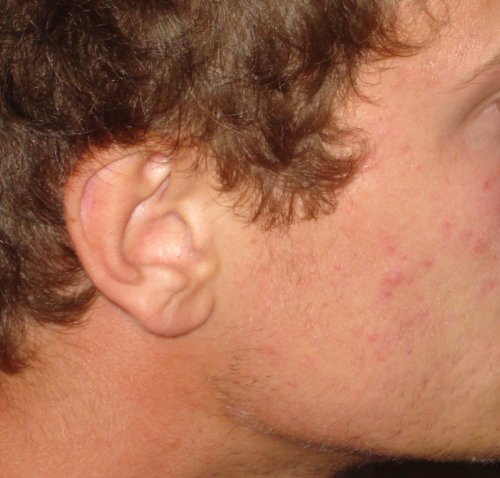 JB repair+care Nachtkerze “ Silber aktiv „… mit dem Silber- / Sauerstoff Komplex, bei Pickeln und Akne, sowie verstopfte Poren - 4