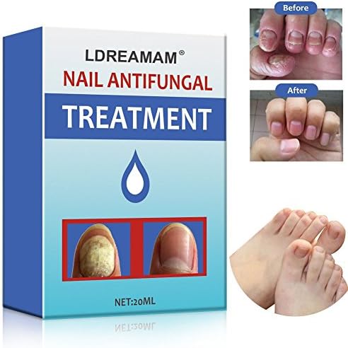 Nail Antifungal Treatment,Anti-Fungal Solution,Toenail Fungus Treatment,Antifungal Nail Gel,Antifungal Fungus Killer finger and Feet Nail Treatment Restore Nails to Their Natural State