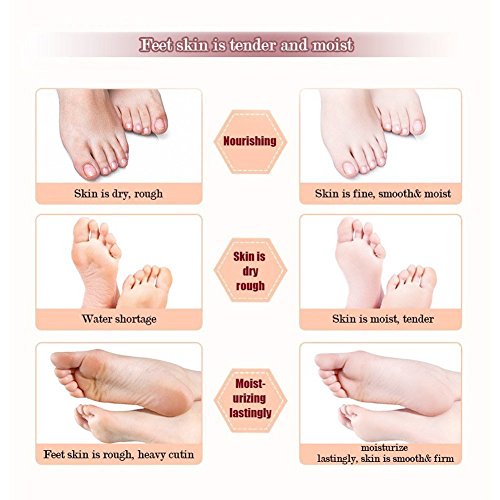 Fuß Peeling Maske,Hornhautsocke,Foot Exfoliation Mask,LDream® Peeling Füße Fuß Maske Perfectly Peeling Away Hornschwiele und Tote Haut Zellen Auch Leckerli unangenehme geruch Peeling, hart und tote Haut,Schwielen Peeling-Maske für die Füße,2 Pack (2 x 2 Stück) - 3