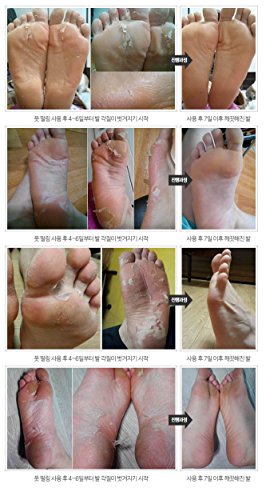 Fuss-Peeling-Maske Made in Korea die Hornhautsocke fuer Samtweiche Füße - 5