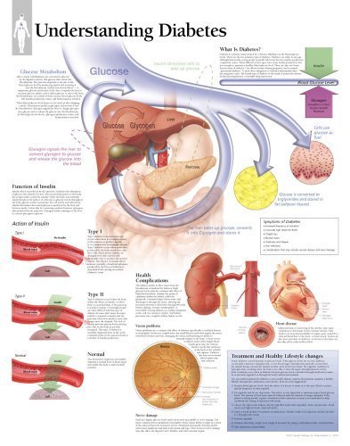 Understanding Diabetes Chart Laminated Wall Chart By Scientific Publishing 2010 03 16 Pdf Kindle Paulkrishna