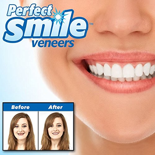 SHOP-STORY - Dent de Remplacement Réutilisable et Amovible, Pose Instantanée de Dents Artificielles Instant Perfect Smile Kit Prothèse Dentaire Supérieure