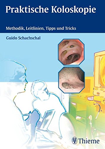Download Praktische Koloskopie: Methodik, Leitlinien, Tipps und Tricks Download Praktische Koloskopie: Methodik, Leitlinien, Tipps und Tricks