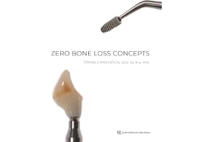 Zero Bone Loss Concepts