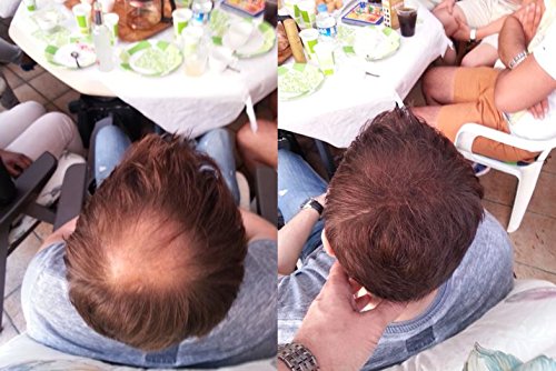 KeraFlow SCHÜTTHAAR STREUHAAR HAARVERDICHTUNG -28g- MIT SOFORTEFFEKT GEGEN TEILGLATZE UND LICHTES HAAR (DUNKELBRAUN) - 8