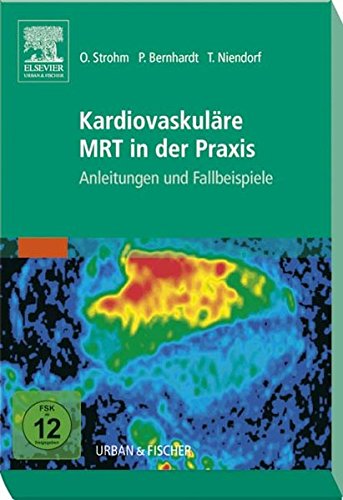 Download Kardiovaskuläre MRT in der Praxis: Anleitungen und Fallbeispiele Download Kardiovaskuläre MRT in der Praxis: Anleitungen und Fallbeispiele