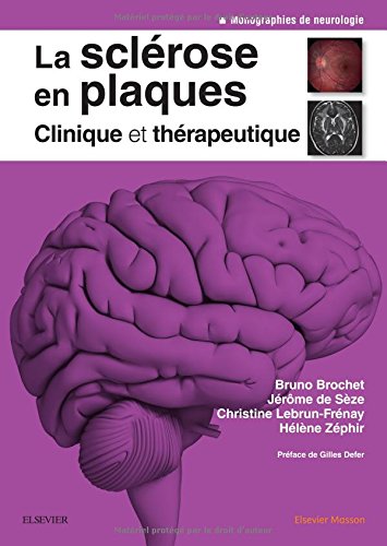 La sclérose en plaques - Clinique et thérapeutique francais