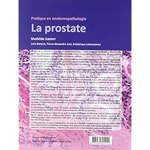 La prostate