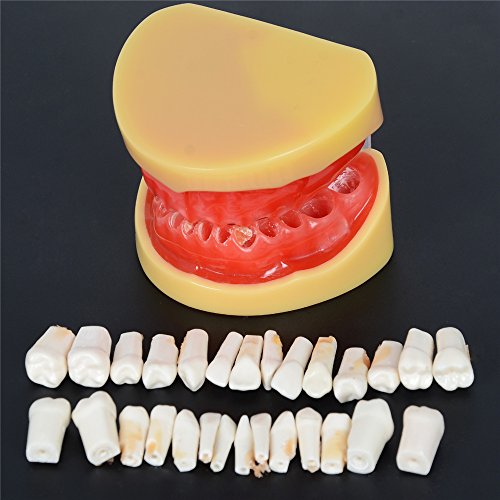 Etelux A11 Dental Teach Studie Erwachsene Standard 28 pcs Demonstration Zähne Modell Flesh Pulver - 3