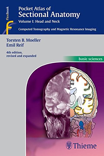 Pocket Atlas of Sectional Anatomy, Volume I: Head and Neck: Computed Tomography and Magnetic Resonance Imaging: 1