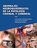 Image de Abordajes neuroquirúrgicos de la patología craneal y cerebral + acceso web