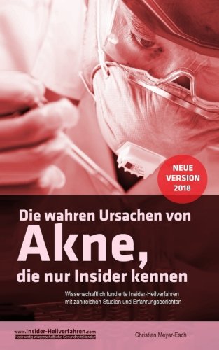 Preisvergleich Produktbild Die wahren Ursachen von Akne, die nur Insider kennen
