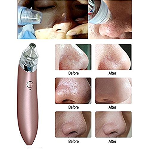 DOXUNGO elektronische Gesichtsreiniger elektrische Pore Cleanser Mitesserentferner und Akne Reinigungsverwendung Vakuum Reinigungsinstrument für Schönheit - 5