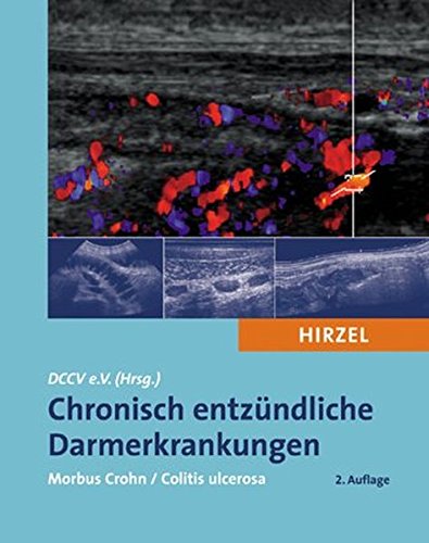 Download Chronisch entzündliche Darmerkrankungen: Morbus Crohn / Colitis ulcerosa Download Chronisch entzündliche Darmerkrankungen: Morbus Crohn / Colitis ulcerosa