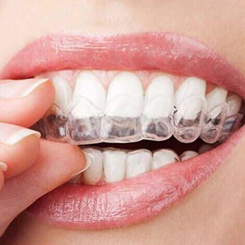 Amazon.co.uk teeth whitening gum shields