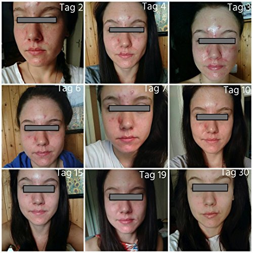 JB repair+care Nachtkerze “ Silber aktiv „… mit dem Silber- / Sauerstoff Komplex, bei Pickeln und Akne, sowie verstopfte Poren - 2