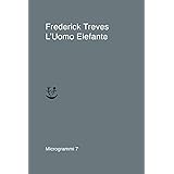 L'uomo elefante