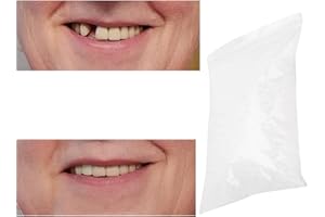 GEGONG Clip nei denti delle faccette, perline di riparazione temporanea dei denti per denti rotti mancanti Materiale di riempimento dei denti dentali, cemento per denti (100g)