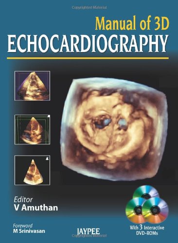 Manual of 3D Echocardiography